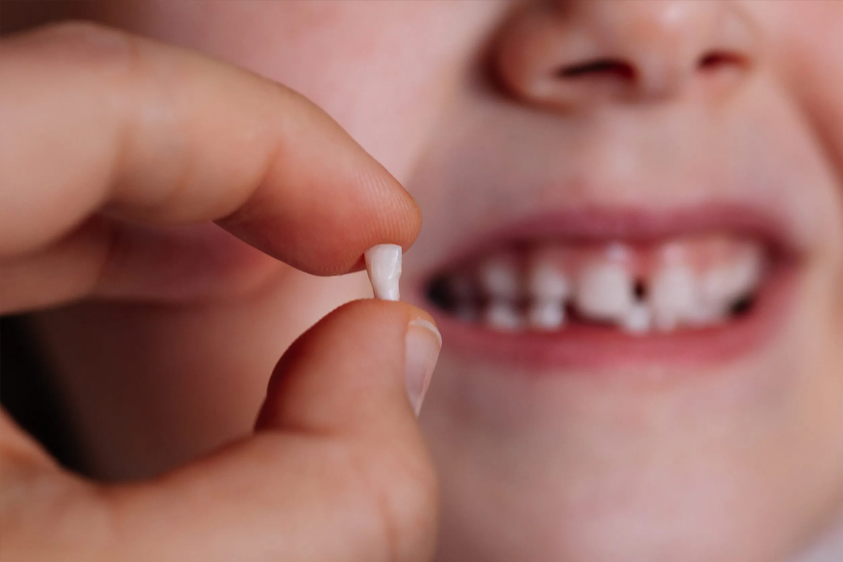 Tips For Preventing Dental Extractions
