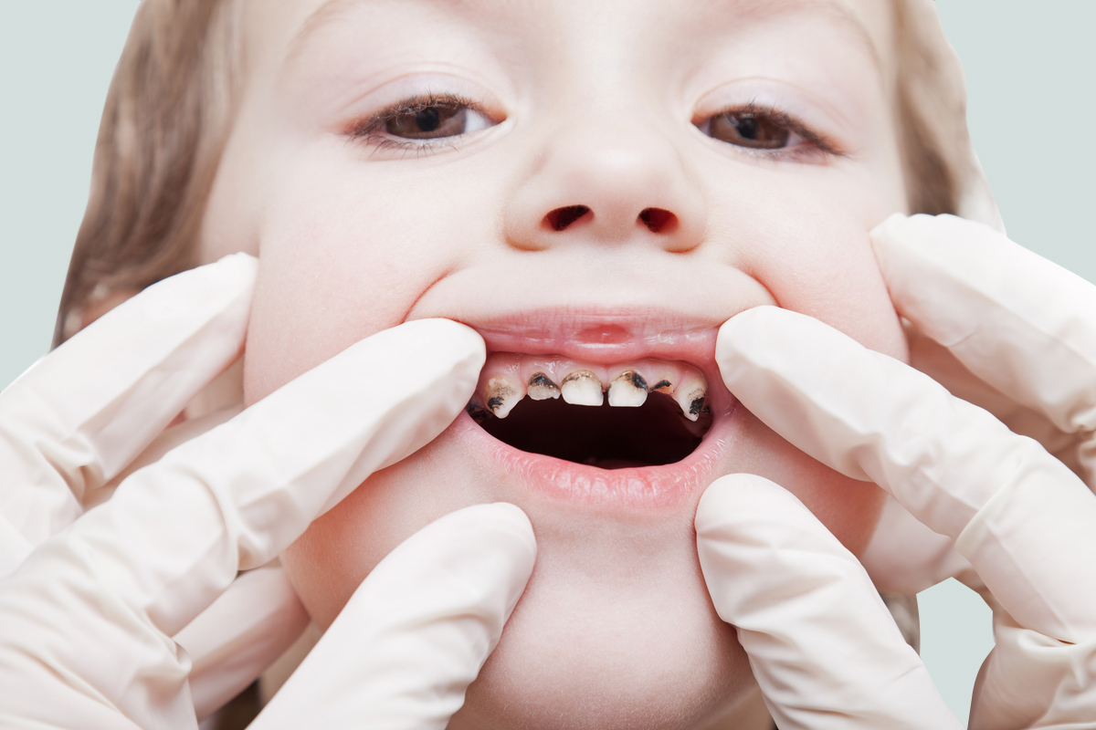 Unexpected Symptoms Of Gum Disease