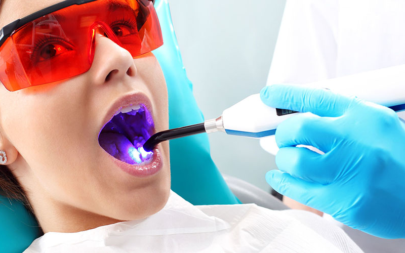 Laser Dentistry For Cavity Treatment In Kids